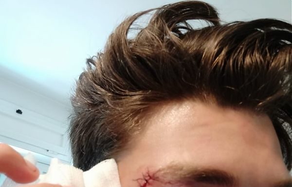 INDOSSANO MAGLIETTA ANTIFASCISTA, 4 RAGAZZI PICCHIATI A TRASTEVERE