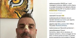 NASO ROTTO PER SORRENTINO “MA HO FERMATO RONALDO”