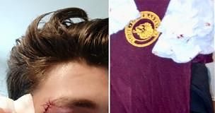 PICCHIATI PER UNA MAGLIETTA ANTIRAZZISTA