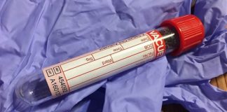 BLITZ ANTIDOPING A SEEFELD, ARRESTATI 5 ATLETI