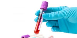 ITALIA PRIMA IN EUROPA PER IL ‘PATIENT BLOOD MANAGEMENT’