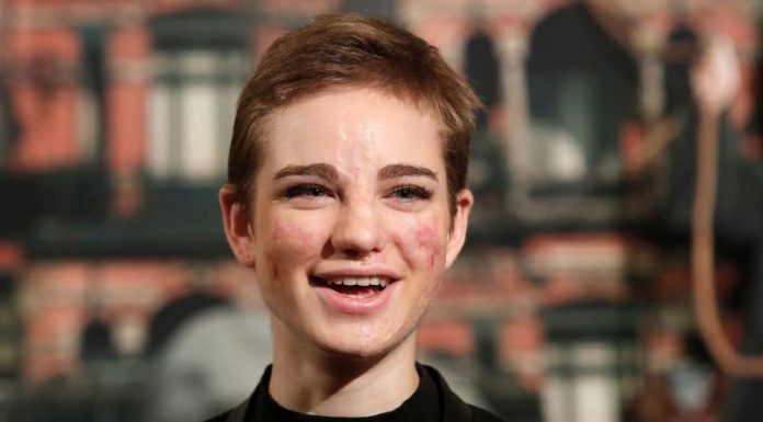 AMSTERDAM ULTIMA TAPPA 2019 DELLA CDM PARALIMPICA