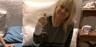 LITTIZZETTO CADE IN STRADA, BRACCIO E GAMBA INGESSATI