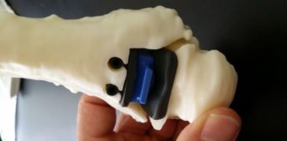 CAVIGLIA RICOSTRUITA IN 3D AL RIZZOLI DI BOLOGNA