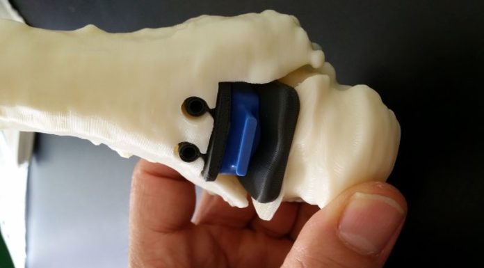 CAVIGLIA RICOSTRUITA IN 3D AL RIZZOLI DI BOLOGNA