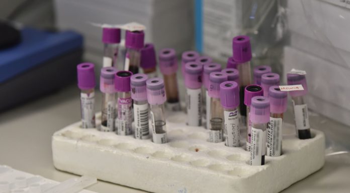 CORONAVIRUS CINESE: RIENTRA ALLARME IN ITALIA, PRIMI CASI IN EUROPA