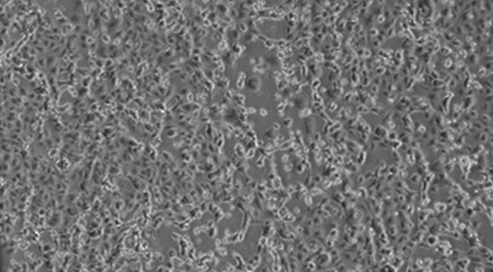 Coronavirus, stabili le condizioni dei coniugi cinesi