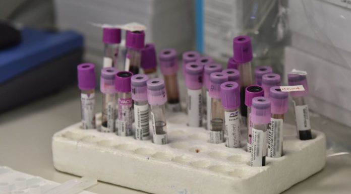 Coronavirus, c’e’ un’ipotesi sui “pazienti zero” in Veneto