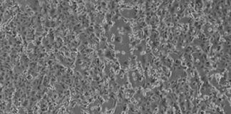 Coronavirus, i coniugi cinesi continuano a migliorare