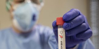 Valle d’Aosta attiva nuove strutture, 671 i positivi attuali