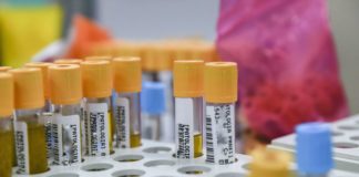 Covid, 192 nuovi casi in Italia. Sette i decessi