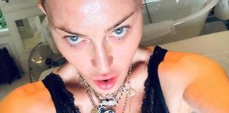 Madonna “Mi sottoporrò a un intervento di medicina rigenerativa”