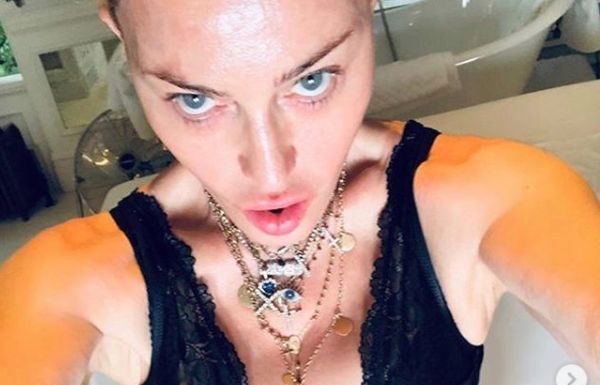 Madonna “Mi sottoporrò a un intervento di medicina rigenerativa”
