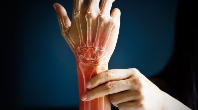 In Europa 3 mln affetti da artrite reumatoide, arriva nuovo trattamento