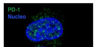Con un falso comando i tumori ingannano le cellule “natural killer”