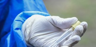 Coronavirus, da Granarolo 150.000 euro a Fondazione S.Orsola per ricerca