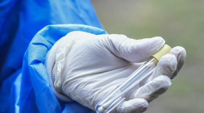 Coronavirus, da Granarolo 150.000 euro a Fondazione S.Orsola per ricerca