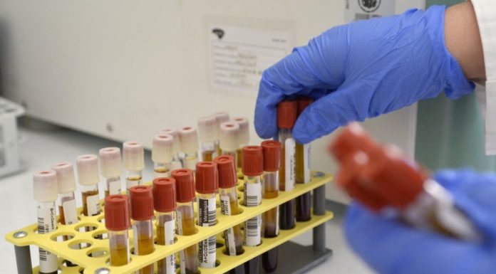 Covid, Donato “Assenza di strategia sarà letale per la Sicilia”