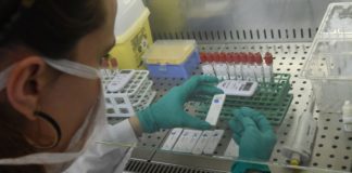 In Piemonte approvato protocollo per la gestione dei test sierologici