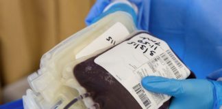 Coronavirus, Riccardi “Fvg è attrezzato per terapia al plasma”