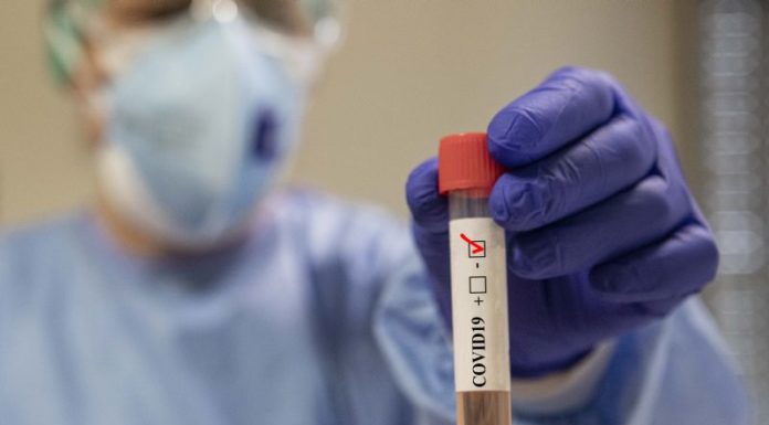 Coronavirus, 170 positivi e 5 decessi nelle ultime 24 ore