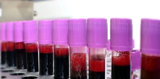 Emergenza sangue in Toscana, ad agosto donazioni in calo del 15%