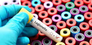 Accertati 16 casi di legionella a Busto Arsizio, un morto