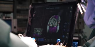 L’intelligenza artificiale per la protesi del ginocchio