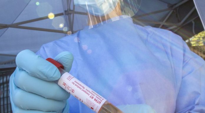 Coronavirus, Oms “L’Italia ha reagito con forza”