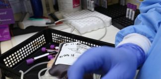 Coronavirus, in Emilia Romagna studio per produrre plasma iperimmune