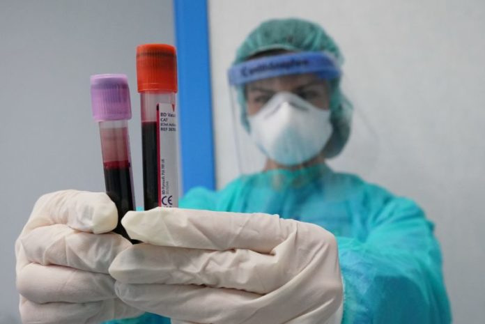 TEST SIEROLOGICI ALL'OSPEDALE ISRAELITICO