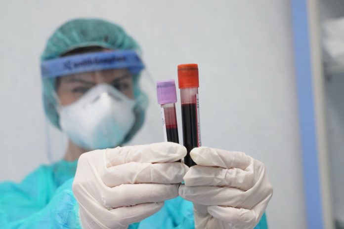TEST SIEROLOGICI ALL'OSPEDALE ISRAELITICO