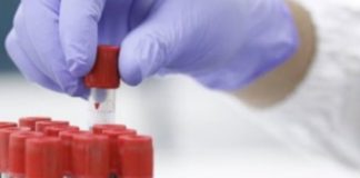 Commissione Ue dice sì ad atezolizumab per carcinoma epatocellulare