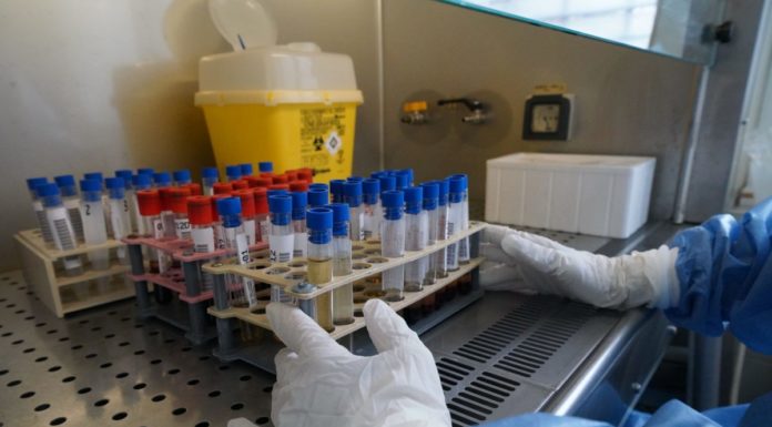 Tumori, primo report in Italia sulle terapie CAR-T