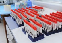 Alla Run Rome The Marathon screening gratuito degli anticorpi per diabete e celiachia per gli under 18