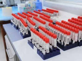 Alla Run Rome The Marathon screening gratuito degli anticorpi per diabete e celiachia per gli under 18