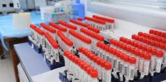 Fnopi “Sui tamponi garantire massima sicurezza a pazienti”