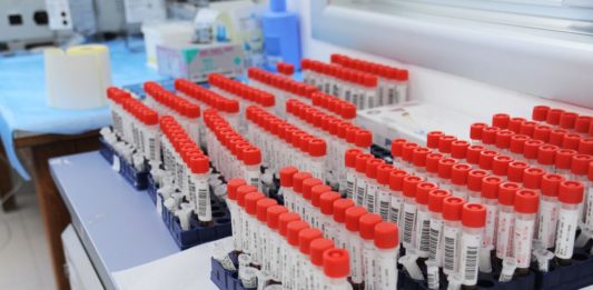 Alla Run Rome The Marathon screening gratuito degli anticorpi per diabete e celiachia per gli under 18