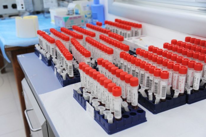 LABORATORIO LABORATORI TEST TAMPONE TAMPONI COVID 19
PROVETTE PROVETTA