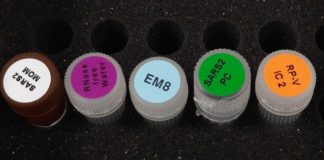 La Fondazione Kennedy dona migliaia di kit per tamponi al Bambino Gesù