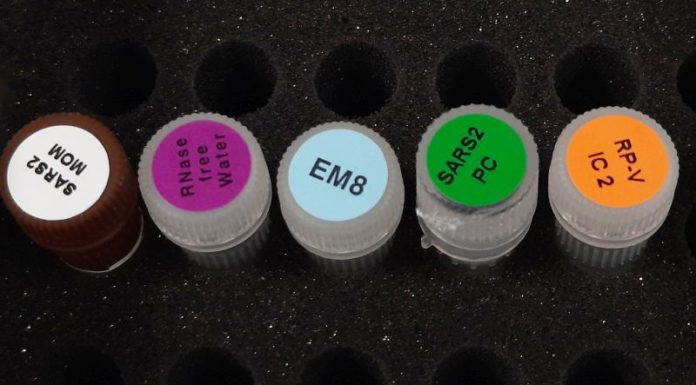 La Fondazione Kennedy dona migliaia di kit per tamponi al Bambino Gesù