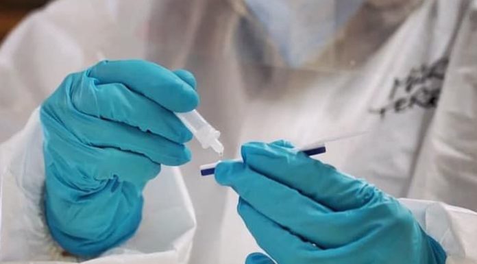 Iss, l’epidemia resta a livelli critici