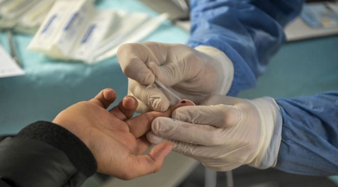 Covid, 20.648 nuovi casi e 541 vittime nelle ultime 24 ore