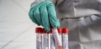 Coronavirus, In FVG nelle RSA 39 anziani e 45 operatori contagiati