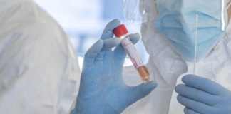 Coronavirus, Speranza e Boccia “Diffida per revoca ordinanza Abruzzo”