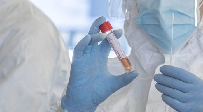 Coronavirus, Speranza e Boccia “Diffida per revoca ordinanza Abruzzo”