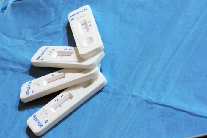 COMUNE DI BARI TEST SIEROLOGICI PER I DIPENDENTI