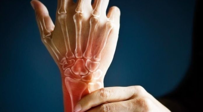 Artrite reumatoide, il farmaco Rinvoq adesso rimborsabile in Italia