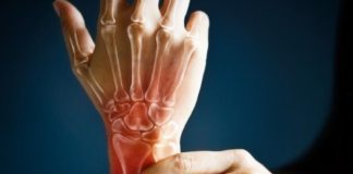 Artrite reumatoide, il farmaco Rinvoq adesso rimborsabile in Italia