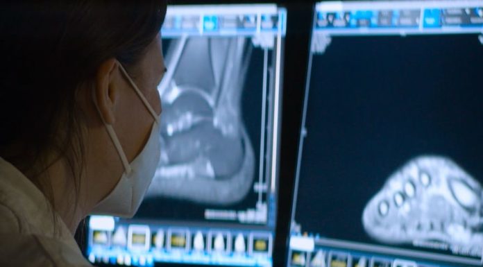 Una nuova Breast Unit per la Fondazione Giglio di Cefalù